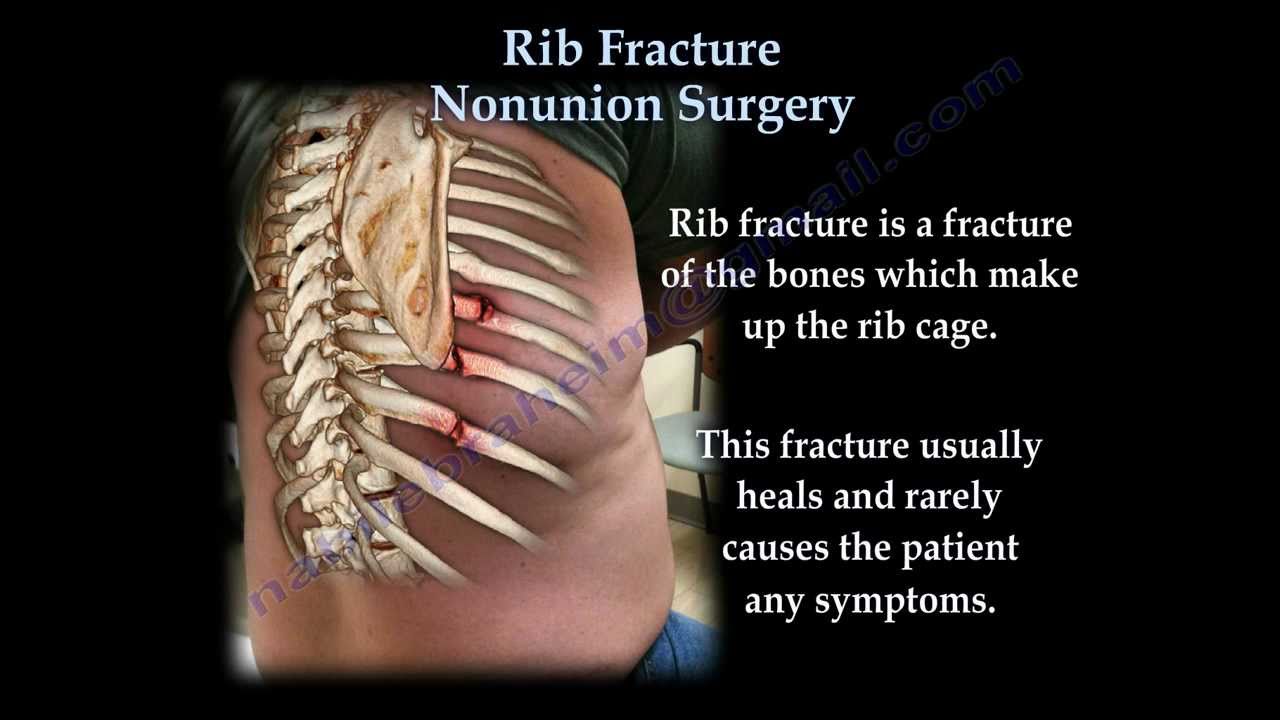 fractured ribs healing time